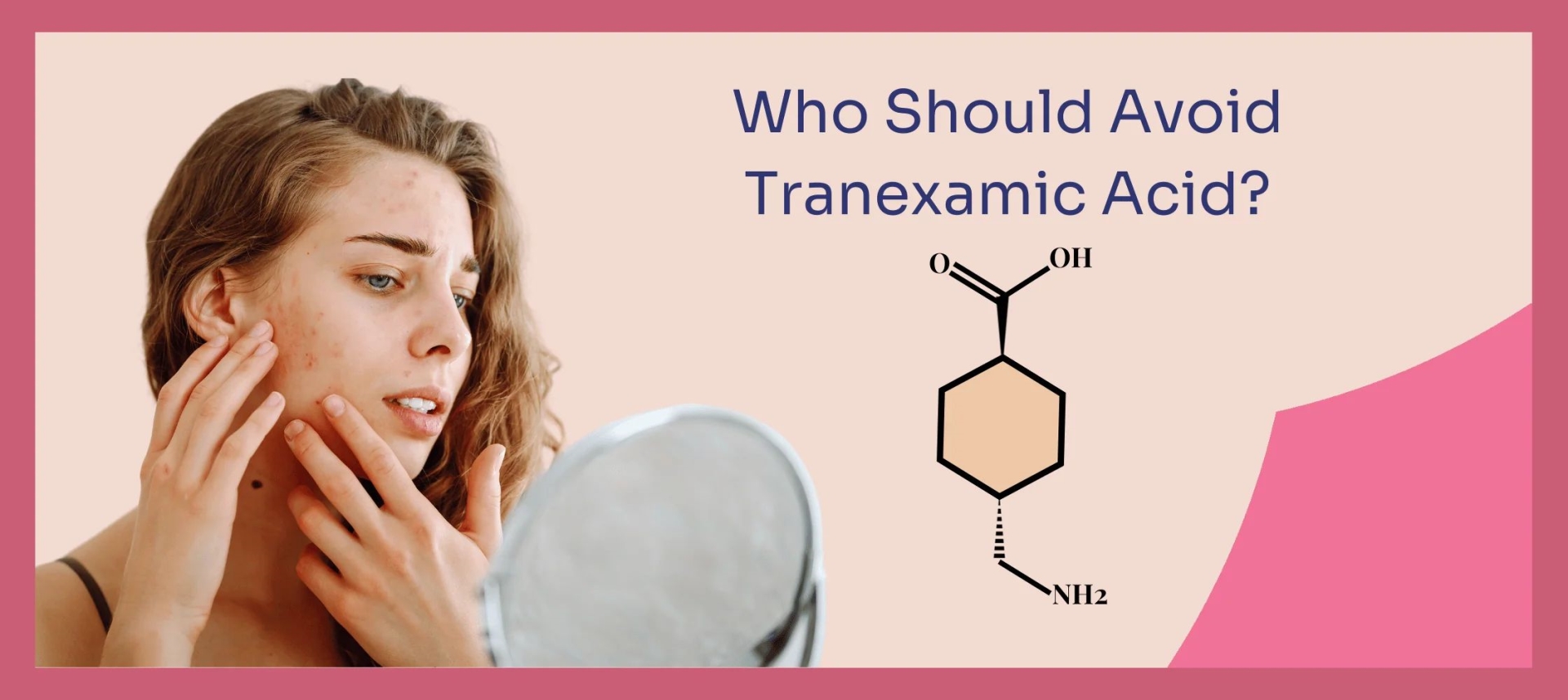 网红“氨甲环酸”被批准用于色斑治疗了吗？